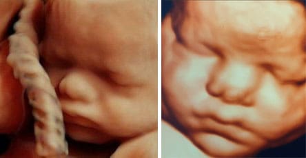 3D-echo maken in Rotterdam